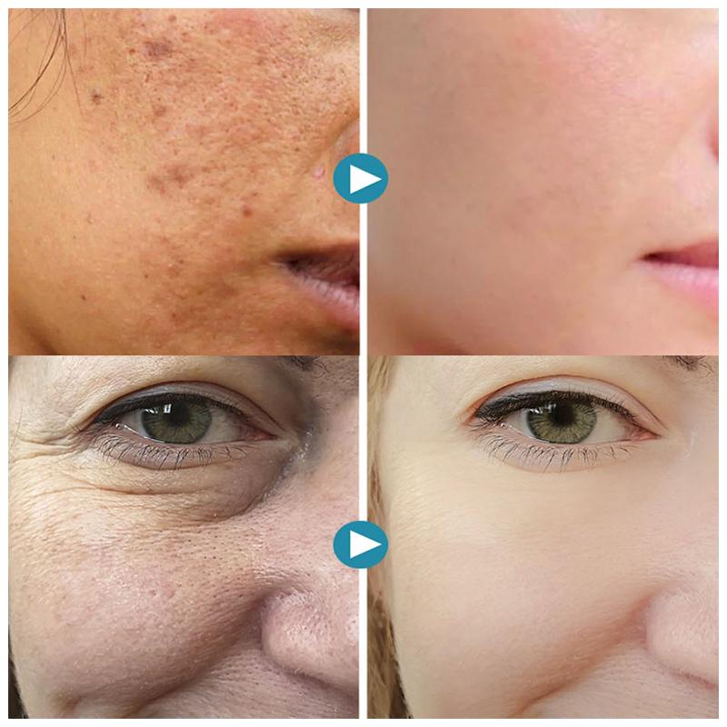 SilkPores Glatte und strahlende Haut | Brehn