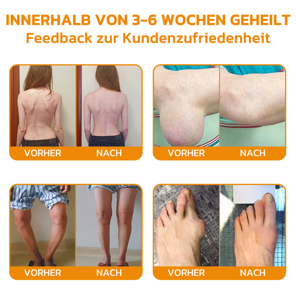 Bienenvenom Gelenkcreme | Brehn
