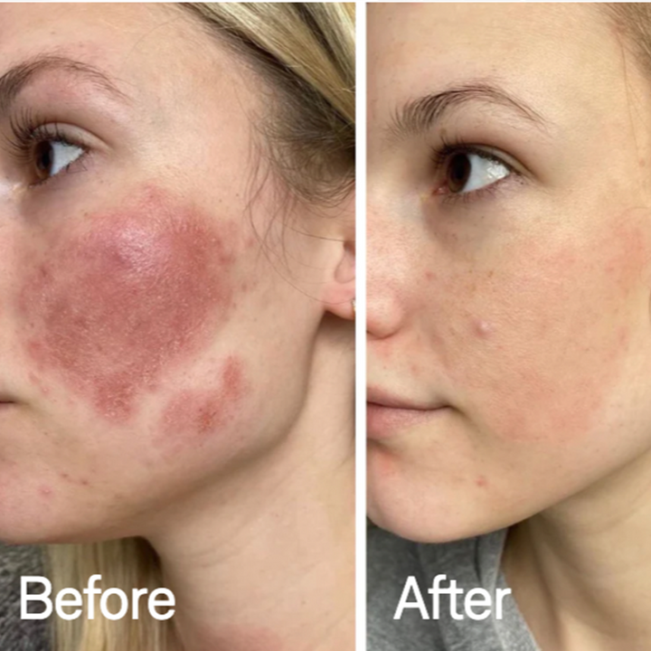 VitaleSkin Maske | Brehn