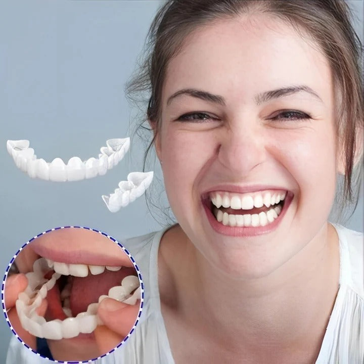 Herausnehmbare Veneers für Ober- und Unterkieferzähne