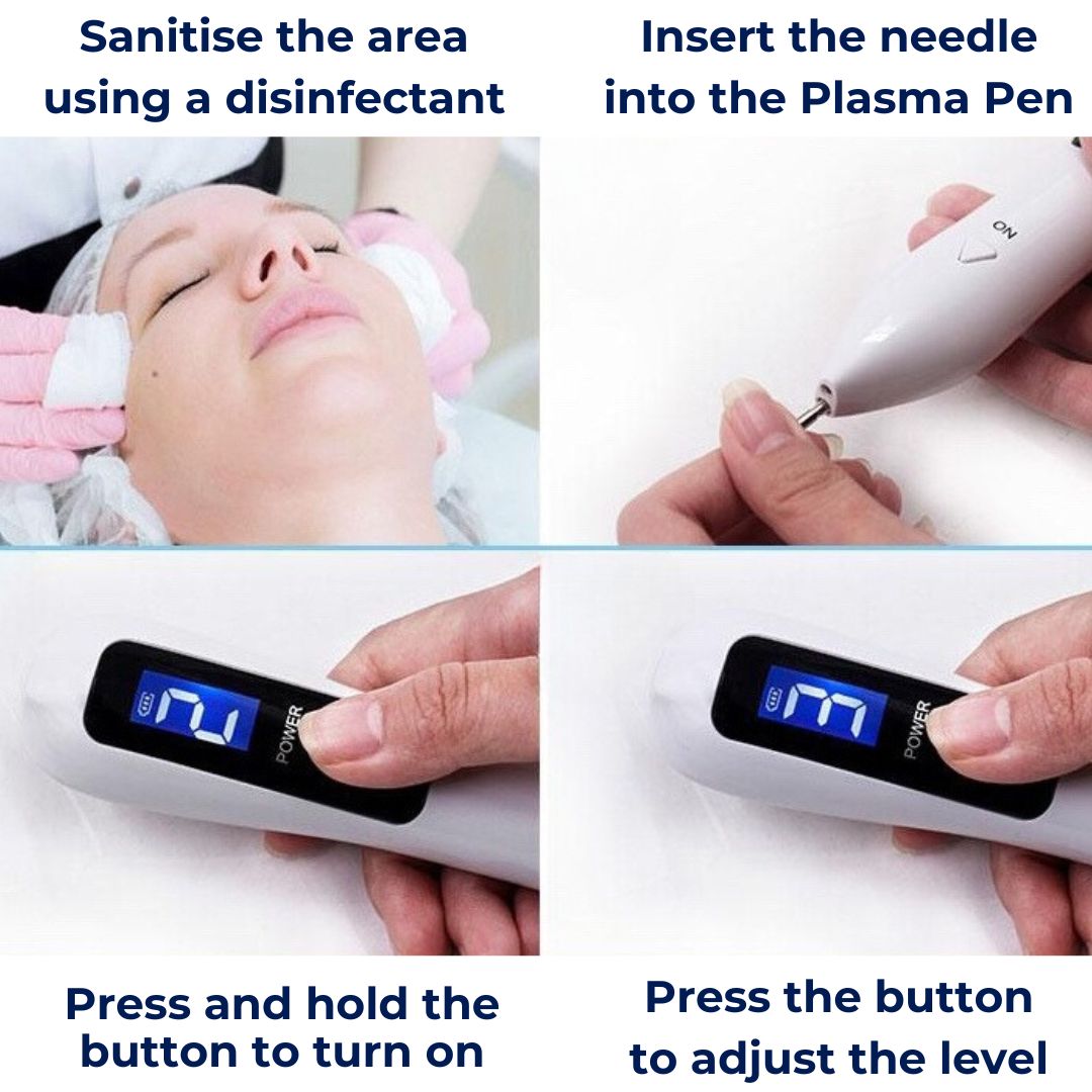 ClearSkinPro Laser Plasma Pen - Nicht-invasiv | zur Entfernung von Sommersprossen, Hautflecken, Punkten, Muttermalen und Tätowierungen zu Hause Brehn