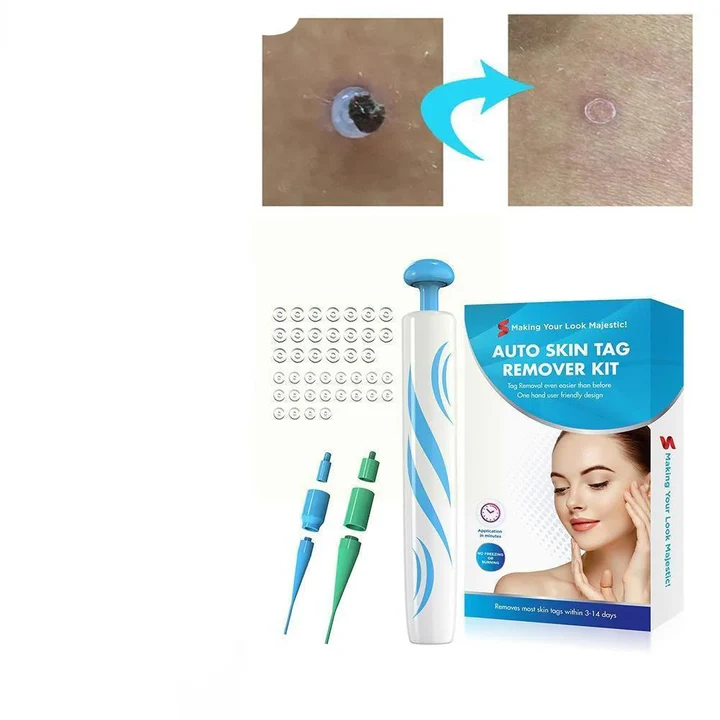Brehn | DermaClear Hautwarzenentferner | Schmerzfreie Anwendung | Kompakt & Hygienisch | Für Männer & Frauen