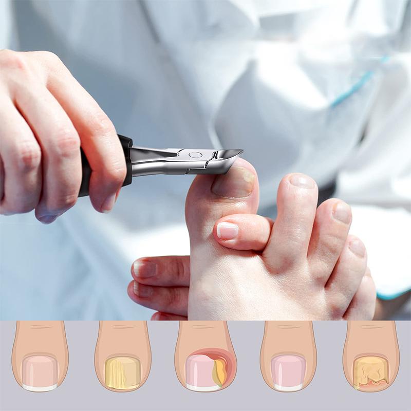 304 Edelstahl Nagelknipser Set | Brehn