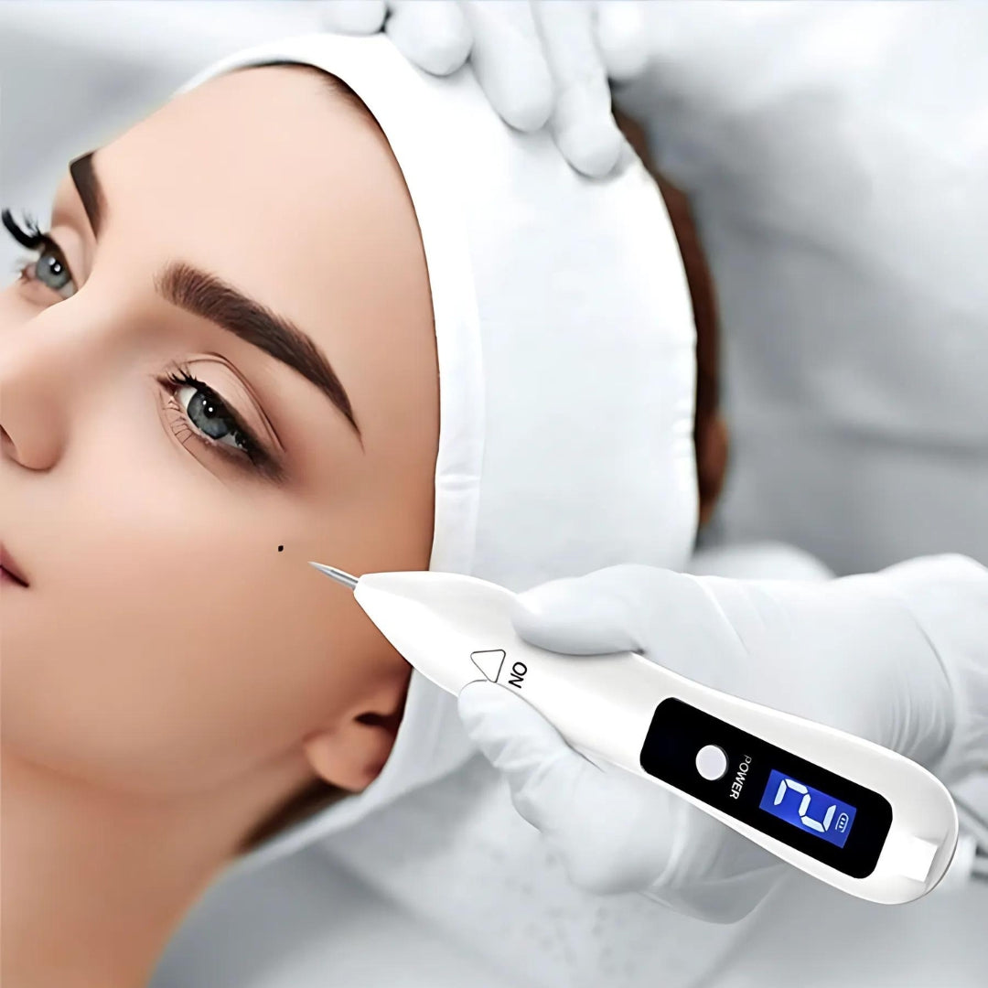 ClearSkinPro Laser Plasma Pen - Nicht-invasiv | zur Entfernung von Sommersprossen, Hautflecken, Punkten, Muttermalen und Tätowierungen zu Hause Brehn