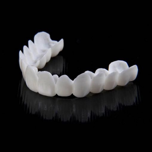 Sofortige Verschönerung Ihres Lächelns mit Snap-on-Veneers