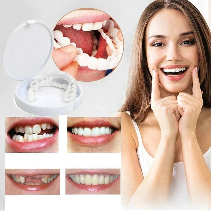 Sofortige Verschönerung Ihres Lächelns mit Snap-on-Veneers