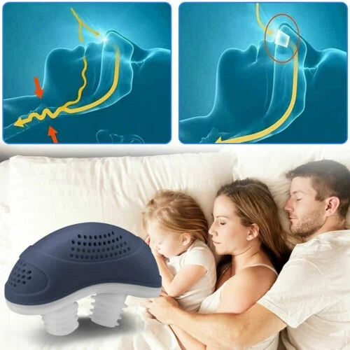 Schlaflos, maskenlos, Micro-CPAP Anti-Schnarch