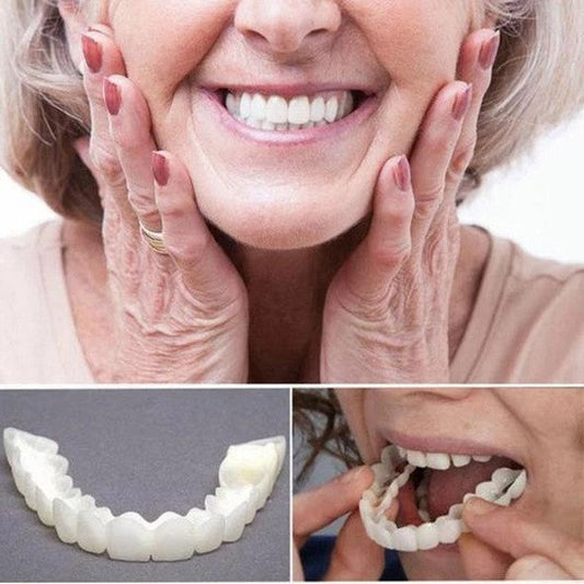 Brehn | On Smile Veneers (Ober- und Unterkiefer inbegriffen)