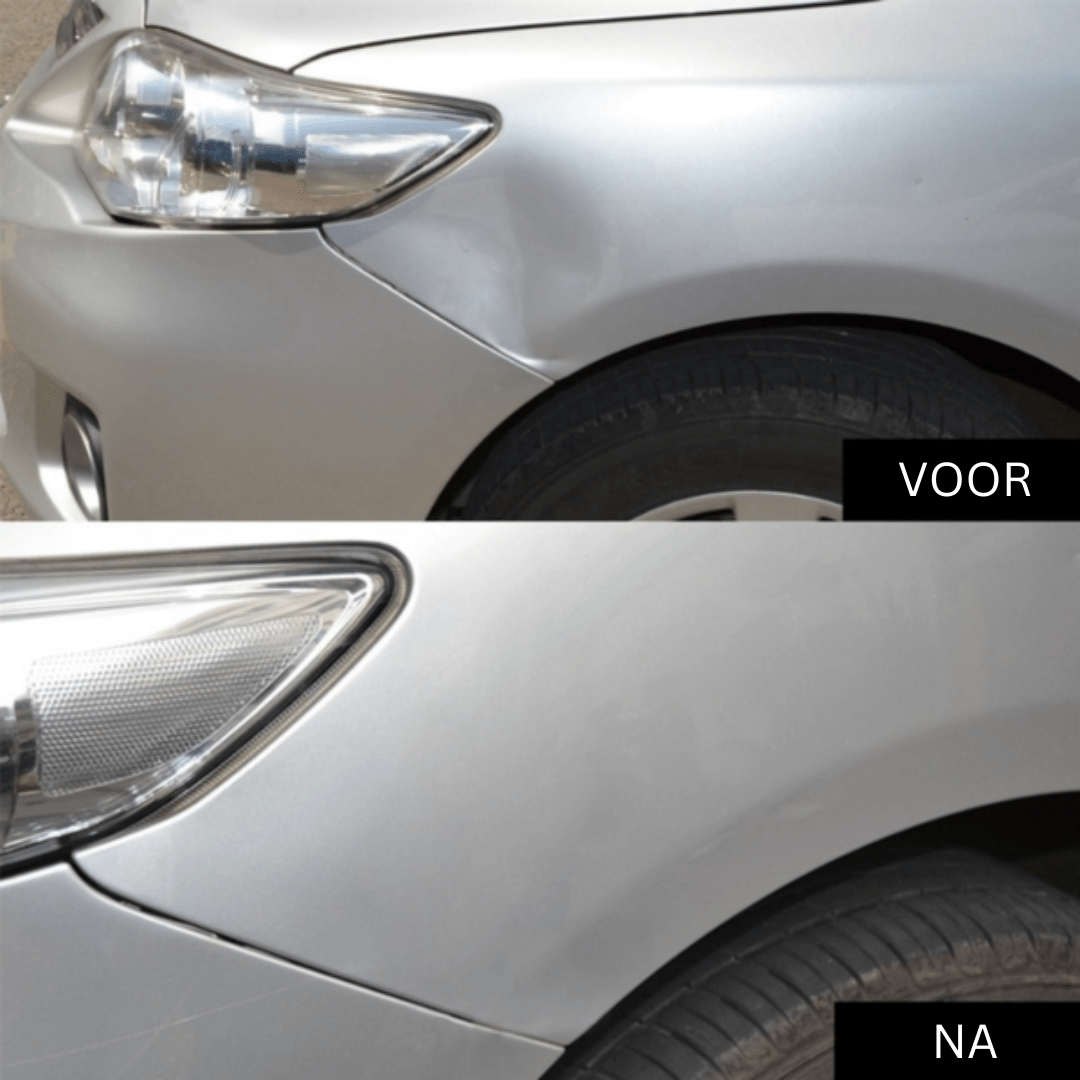 Fixdent Reparieren Sie Ihre Automotiven Träume | Brehn