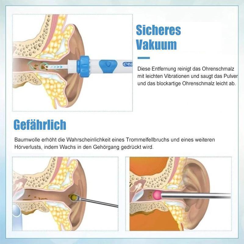 Brehn | Ohrenschmalzentferner Staubsauger