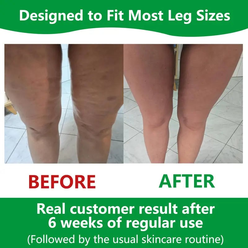 Brehn | Sakerplus Cellulite Massage Roller
