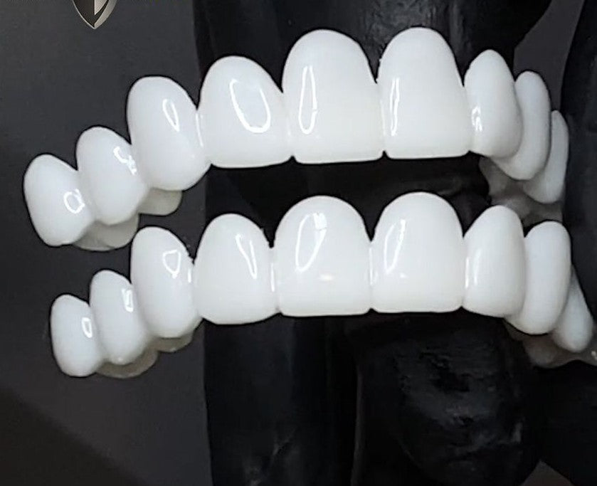 Kosmetische Zahn-Topper SmileShape – Wiederverwendbar, Flexibel und Natürlich Weiß | Brehn