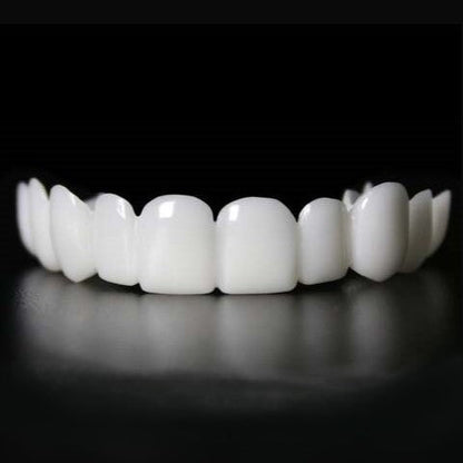 Sofortige Verschönerung Ihres Lächelns mit Snap-on-Veneers