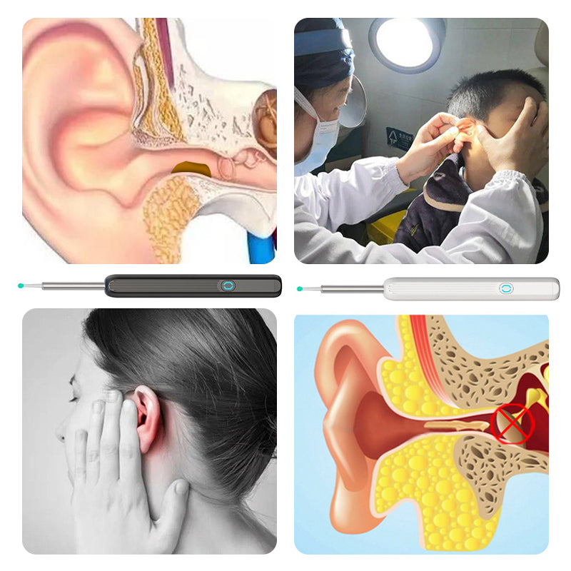 Brehn | Smart sichtbarer Ohrpicker