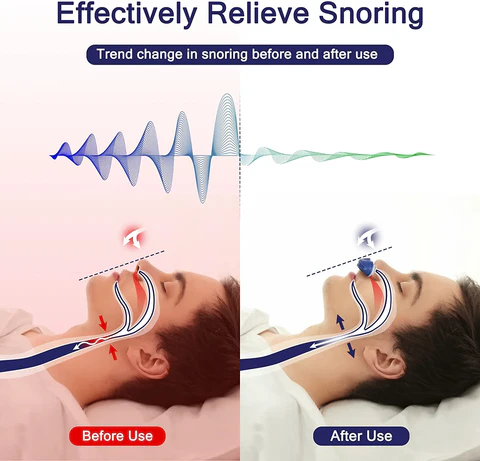 Mikro-CPAP-Schlafapnoegerät für Reisen und gegen Schnarchen