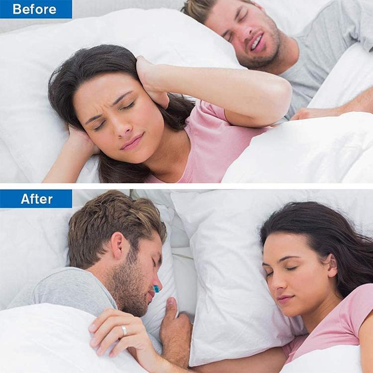 Micro CPAP Anti-Schnarch Elektronisches Gerät