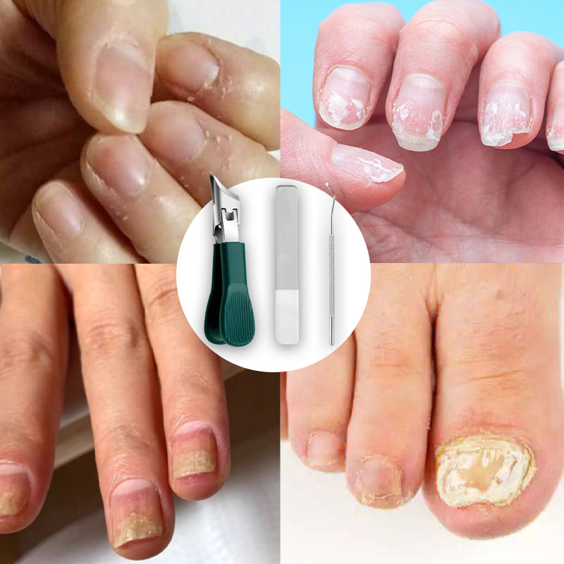 Brehn | Drei Sätze von Adlerschnabel abgeschrägten Nagelknipsern