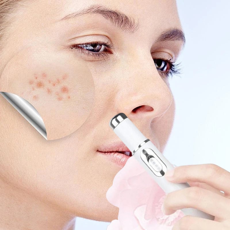 Brehn | ClearDerm - Schnelle, schmerzfreie Pickelentfernung für glatte, klare Haut