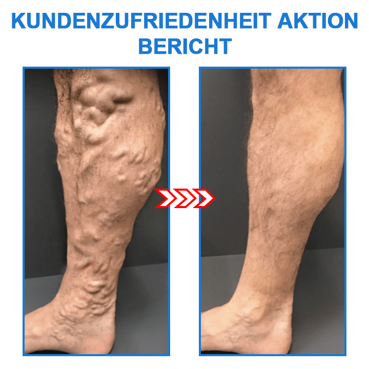 Brehn | Ionische Elastische Socken
