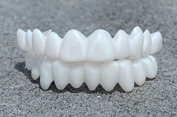 Kosmetische Zahnaufsätze von SmileShape – Wiederverwendbar, flexibel und natürlich weiß