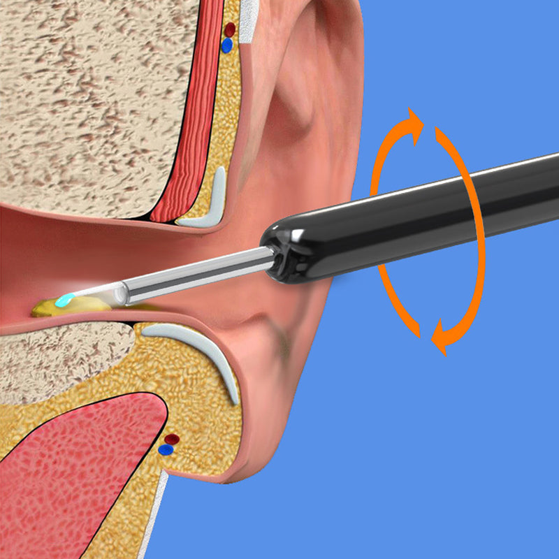Brehn | Smart sichtbarer Ohrpicker