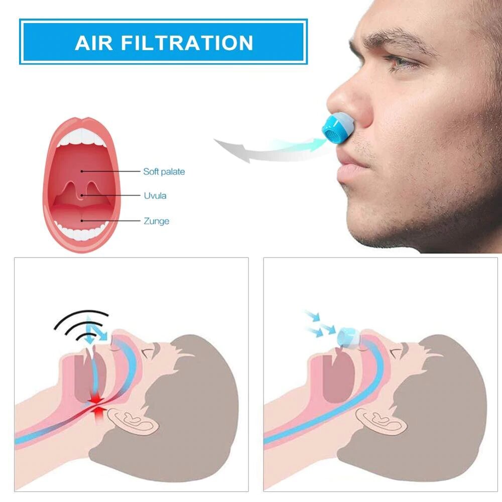 Brehn | Anti-Schnarch-Gerät | Schlauchloses, maskenloses Mikro-CPAP