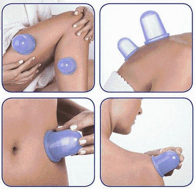Anti-Cellulite-Vakuum-Silikonbecher | Brehn