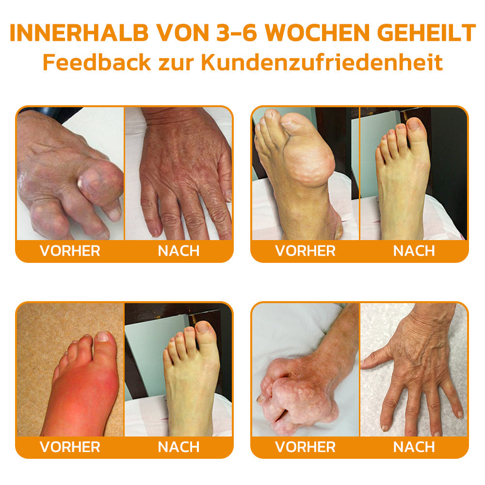 Bienenvenom Gelenkcreme | Brehn