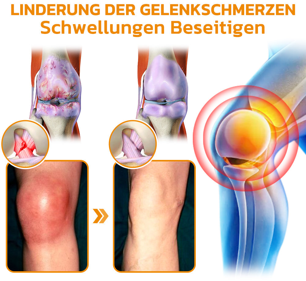 Bienenvenom Gelenkcreme | Brehn