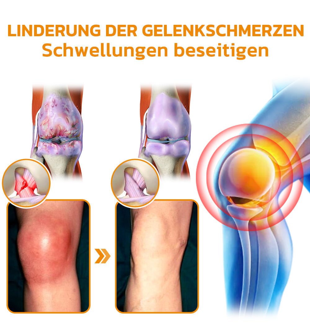 Bienenvenom Gelenkcreme | Brehn