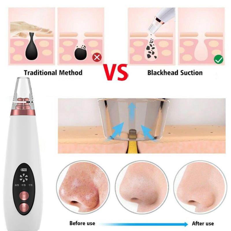 Brehn | Pure Skin wiederaufladbare Mitesserentferner Maschine