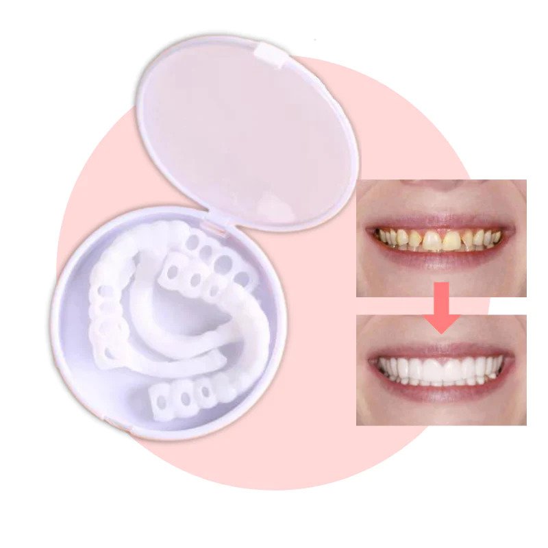 Brehn | SmileSnap Zahnverblendungen – Sofortiges Lächeln mit bequemer Passform