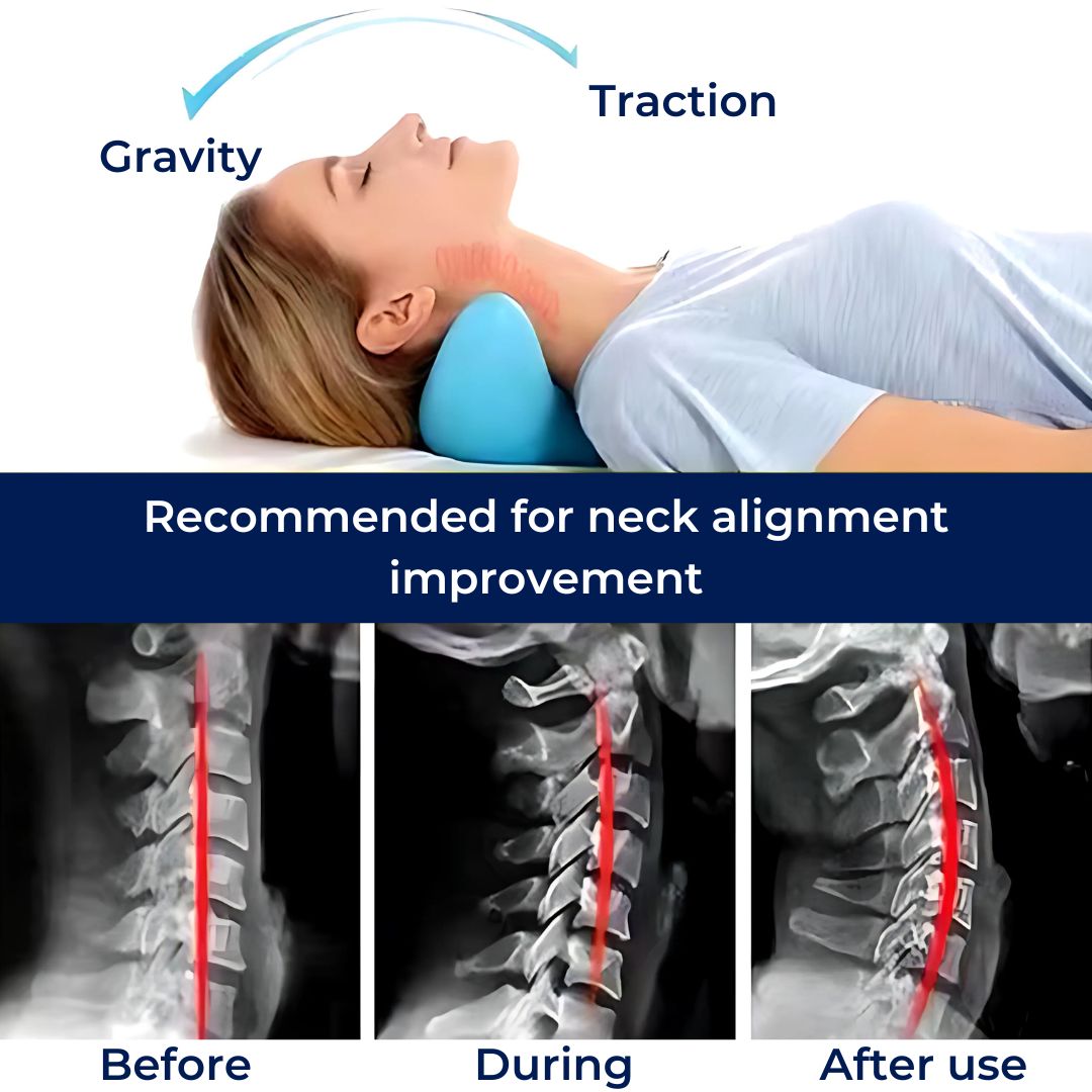NeckAlign Chiropraktisches Nacken-Kissen | Strecker für Nacken - Schmerzlinderung - Verbesserte Haltung - Besserer Schlaf Brehn