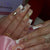 Kunstnagelset mit stilvollen Blüten- und Glitzerakzenten Brehn