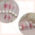 Kunstnagelset mit filigranen Blumen- und Glitzermotiven Brehn