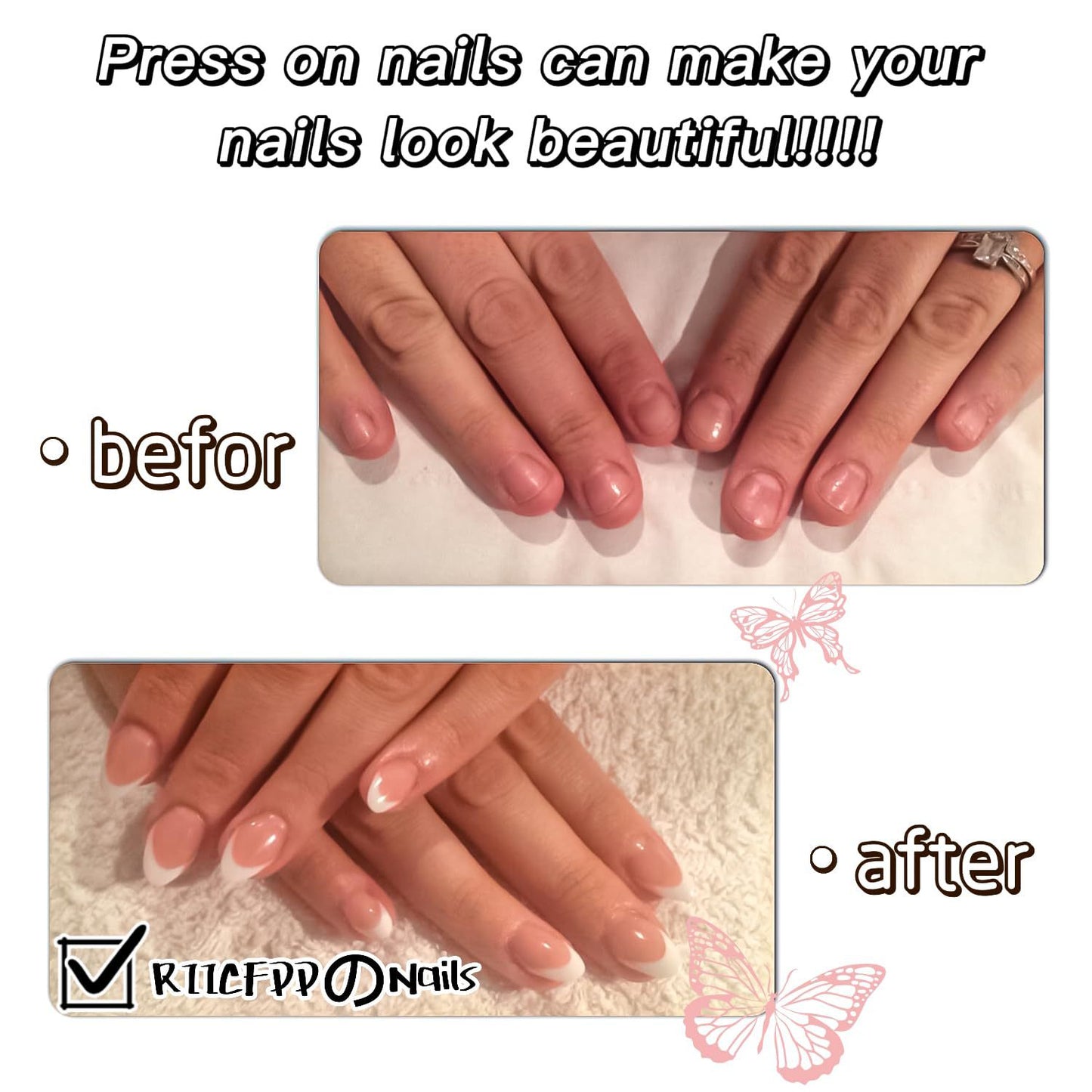 Kunstnagelset mit eleganten Strass-Details und modernen Designs Brehn