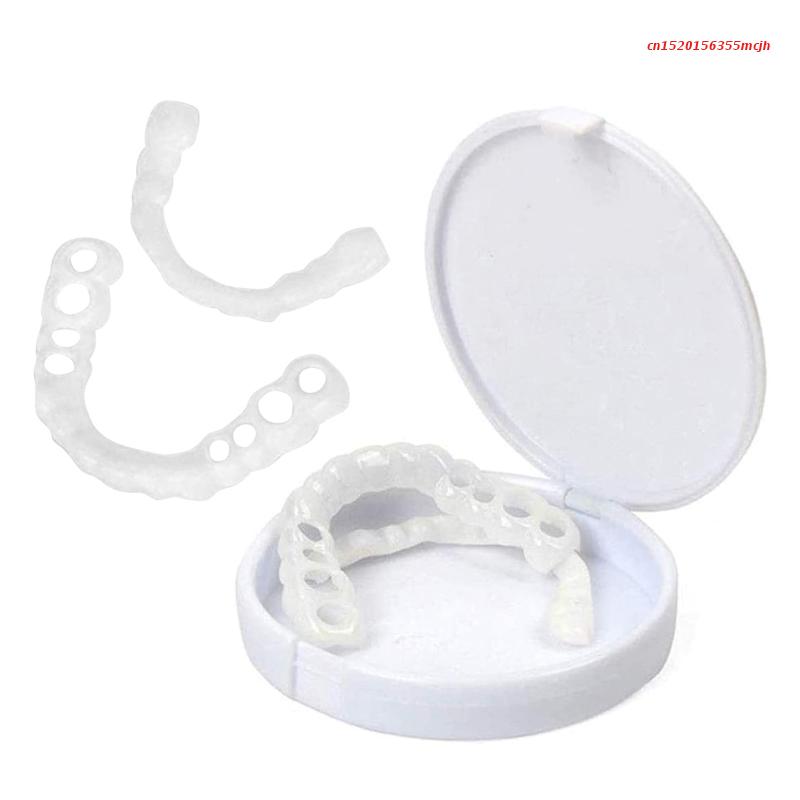 Snap-on Teeth™ – Mit diesen Veneers haben Sie immer ein perfektes Lächeln.