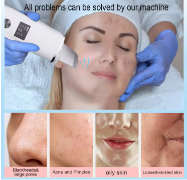 Brehn | SkinPure™ - Deine Haut ist deine Visitenkarte, lass sie strahlen, wie du es verdienst!