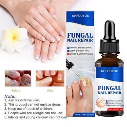 Nagelpilz-Schutzserum