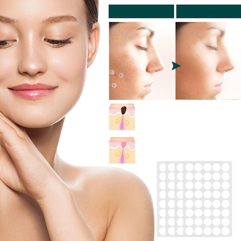 Brehn | SkinClear Skin Tag Remover | Pflaster zur Entfernung von Hautanhängseln & Warzen | Hydrokolloid-Technologie | Schmerzfrei & Diskret | Für alle Hauttypen | 120 Stück