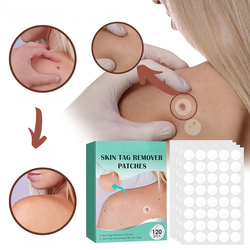 Brehn | SkinClear Skin Tag Remover | Pflaster zur Entfernung von Hautanhängseln & Warzen | Hydrokolloid-Technologie | Schmerzfrei & Diskret | Für alle Hauttypen | 120 Stück