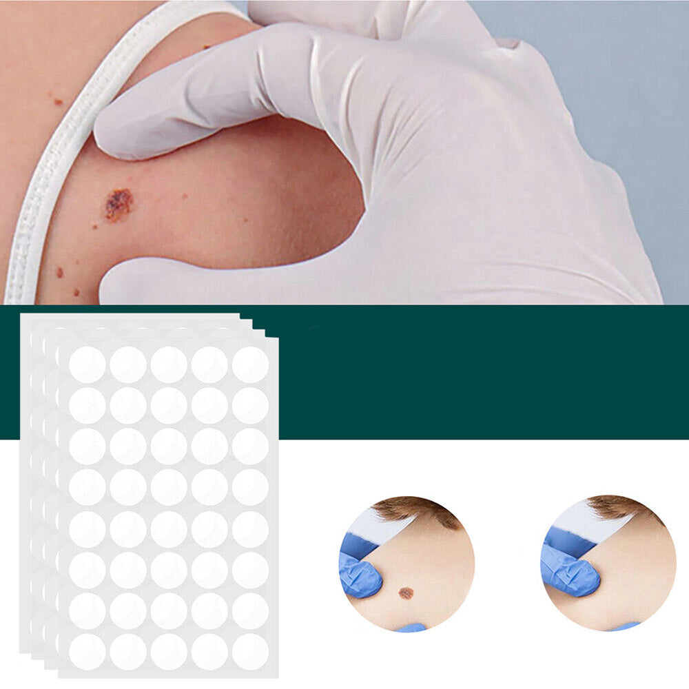 Brehn | SkinClear Skin Tag Remover | Pflaster zur Entfernung von Hautanhängseln & Warzen | Hydrokolloid-Technologie | Schmerzfrei & Diskret | Für alle Hauttypen | 120 Stück