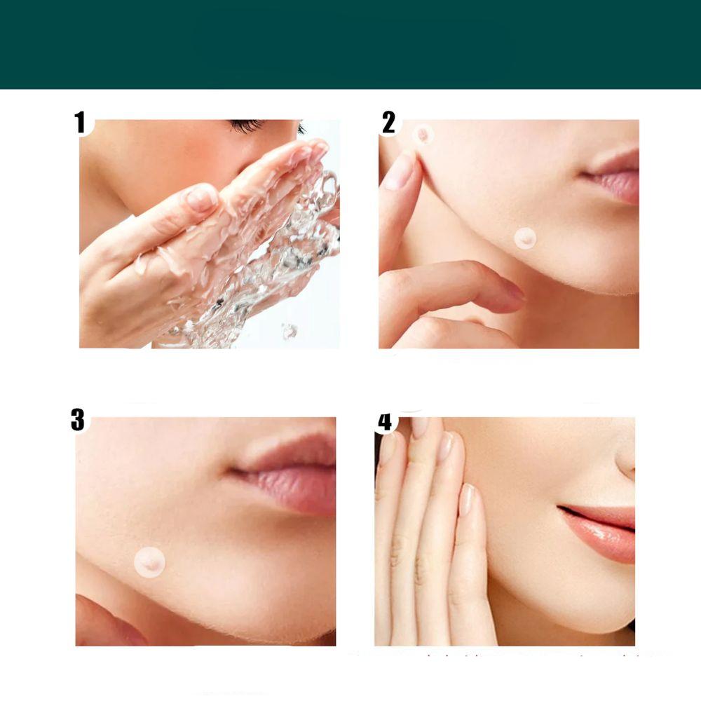 Brehn | SkinClear Skin Tag Remover | Pflaster zur Entfernung von Hautanhängseln & Warzen | Hydrokolloid-Technologie | Schmerzfrei & Diskret | Für alle Hauttypen | 120 Stück