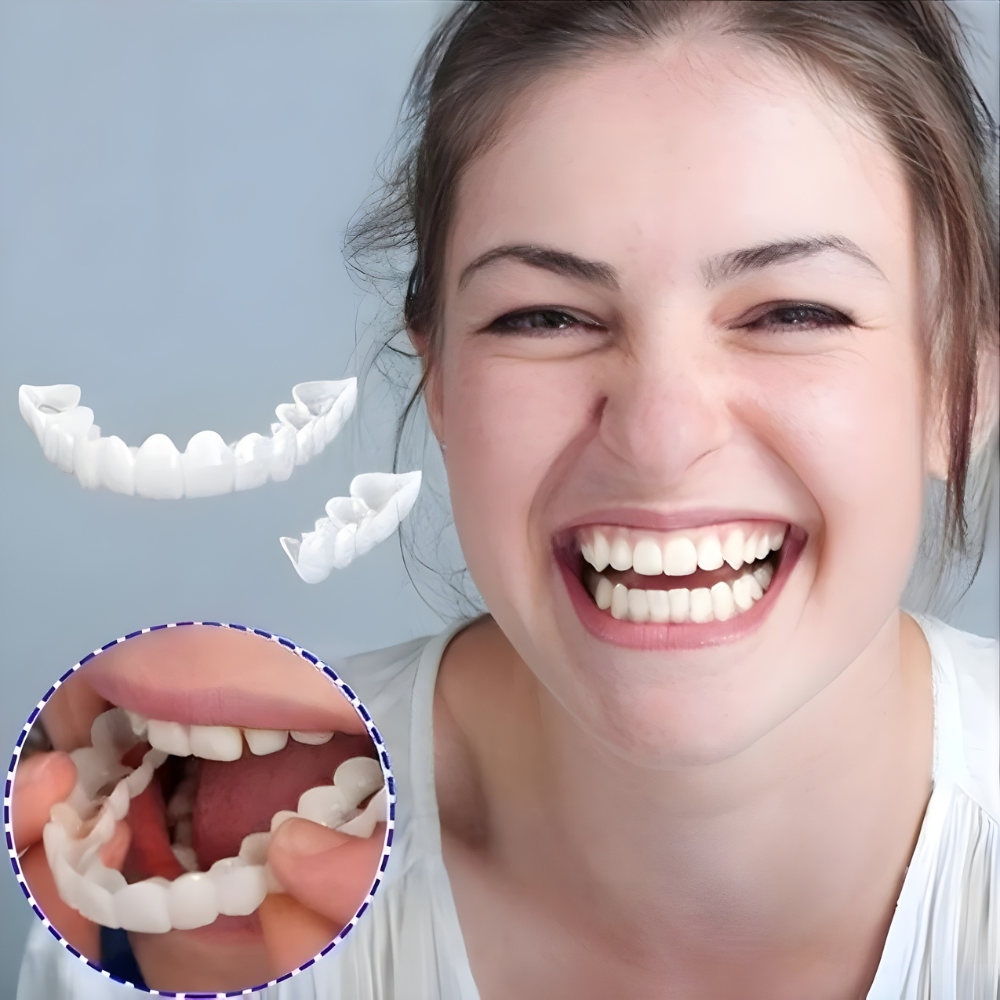 Herausnehmbare Veneers-Zahnverblendschalen