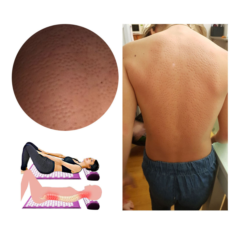 Akupressur-Yogamatte & Kissen-Set - RelaxMat