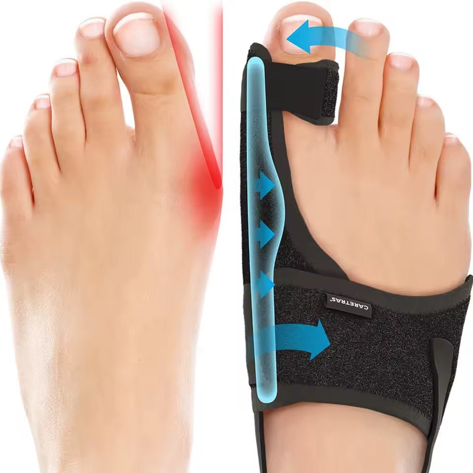Brehn | Nachtschiene Hallux Valgus - Ergonomisch und verstellbar Komfort