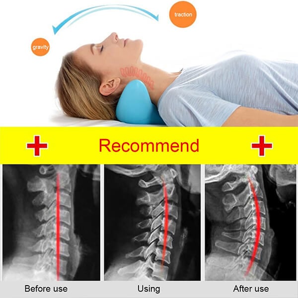 NeckEase Stretch – Ergonomisches Nackenkissen für Nackenentspannung | Brehn