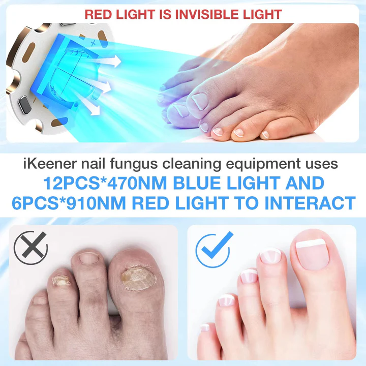 Nagelpilz-Laser