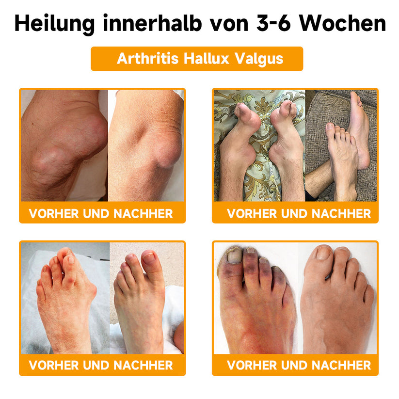 Bienen-Vital-Creme | Schnelle Schmerzlinderung | Brehn