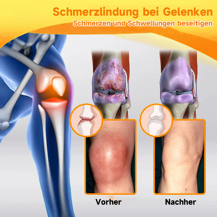 Bienen-Vital-Creme | Schnelle Schmerzlinderung | Brehn